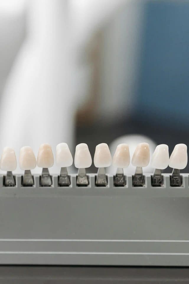 Carillas Dentales
