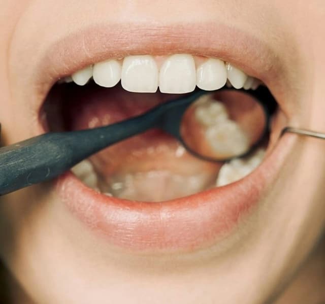 Periodoncia